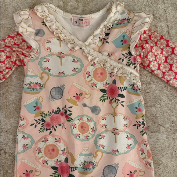 Pete and Lucy Romper - Picture 2 of 5